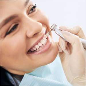 Teeth Cleaning in Clayton, Surrey, and Langley - Smile 64 Clayton Dental