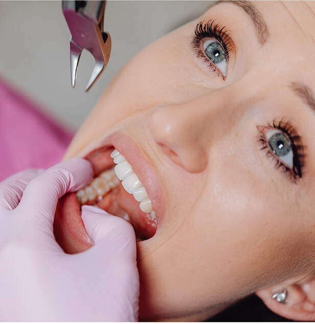 tooth extraction in surrey
