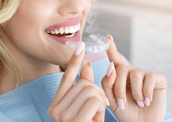 Invisalign Treatment in Surrey